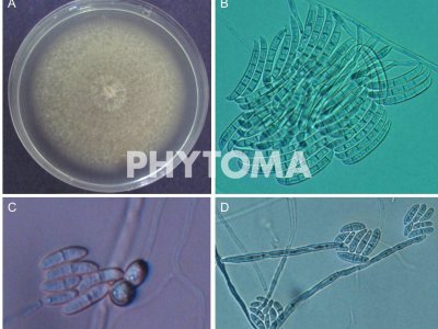 (A)Cultivo monospórico de Fusarium en PDA; (B) Macroconidia (x20A), (C) Clamidosporas terminales en pares y micronidia (x40A);(D) Monofiálidas con microconidias (x 20A)